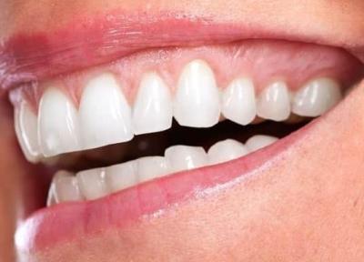 تعبیر خواب دندان درآوردن چیست؟
